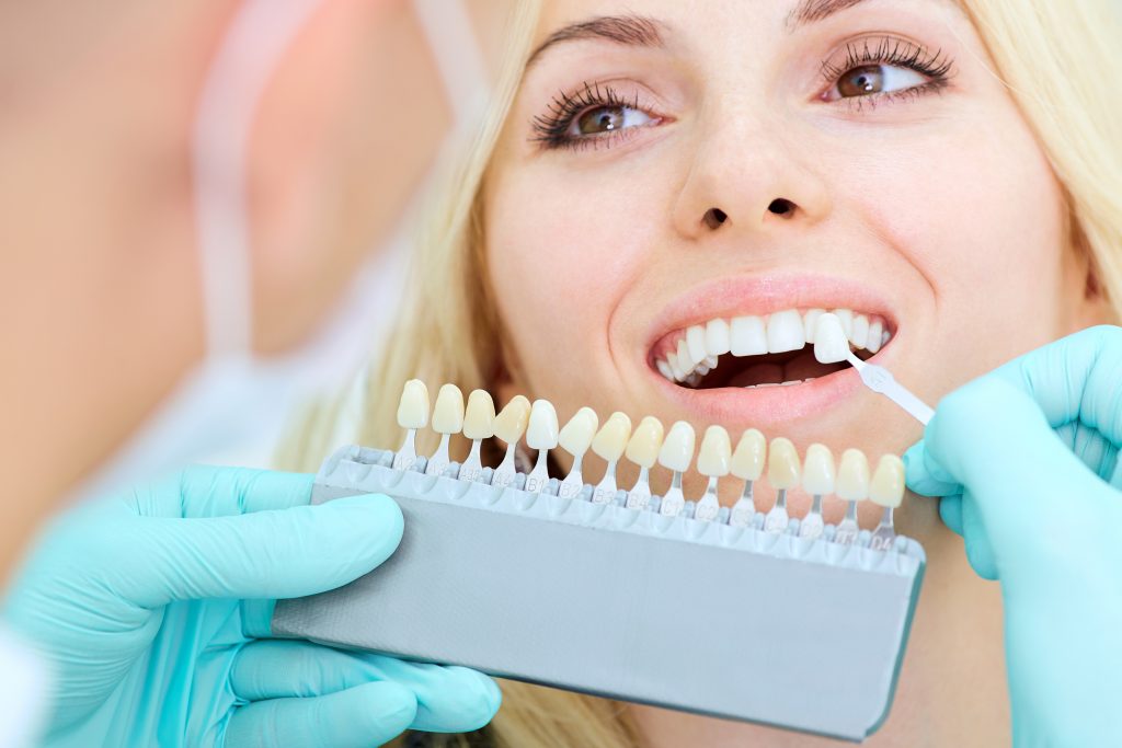 denti perfetti